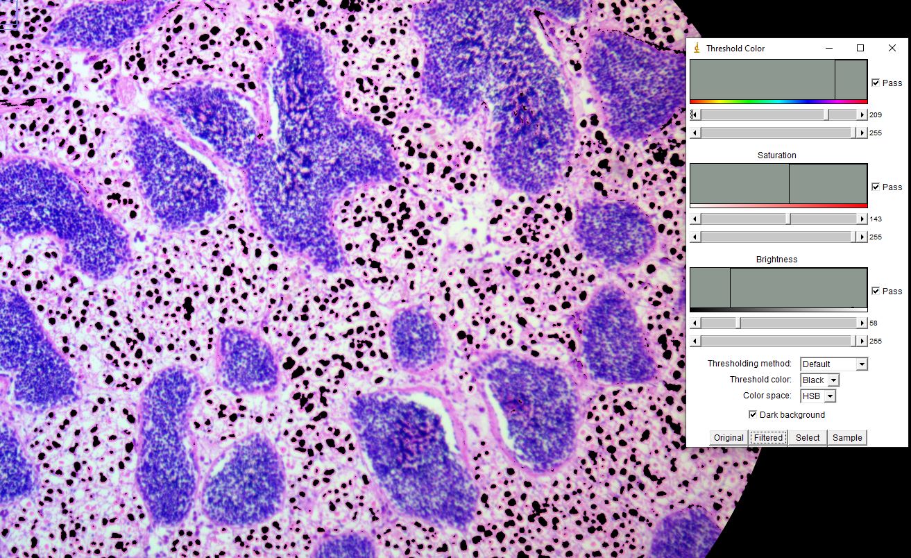 lipid_cells_connective_tissue